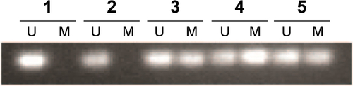 Figure S3 MSP results in DNA agarose gel for PAX1 gene in selected individual normal, CIN1, CIN2, CIN3 and SCC samples.Notes: 1-normal, 2-CIN1, 3-CIN2, 4-CIN3, 5-SCC.Abbreviations: CIN1, cervical intraepithelial neoplasia type 1, CIN2, cervical intraepithelial neoplasia type 2; CIN3, cervical intraepithelial neoplasia type 3; MSP, methylation-specific polymerase chain reaction; M, methylation-specific primers; SCC, squamous cell carcinoma; U, nonmethylation-specific primers.