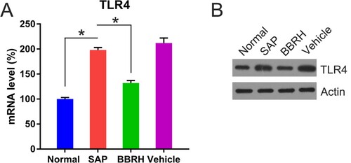 Figure 5. Transcription and translation of TLR4 in pancreatic tissue. (A) Q-PCR is conducted to examine the expression of TLR4 mRNA in pancreatic specimens after 12 h. GAPDH serves as an internal control. (B) WB is used to examine the protein concentration of TLR4. Result is presented in the form of mean ± SD (n = 15 per group). Differences among various groups are assessed using ANOVA. *P < 0.05.