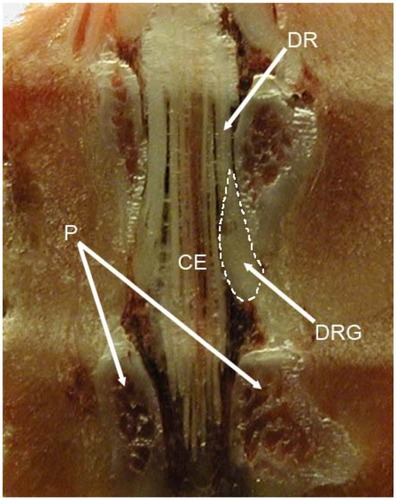 Figure 1 The position of the rat L5 DRG and its relation with surrounding bone structures and cauda equina.