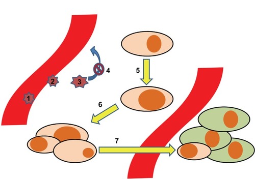 Figure 1 Development of tumor metastases aided by the chemokine system. The process of tumor dissemination is depicted in seven steps: 1. Adhesion/rolling of leukocytes. 2. Transmigration of leukocytes. 3. Maturation of leukocytes. 4. Retention of leukocytes 5. Malignant transformation. 6. Malignant growth. 7. Metastases.