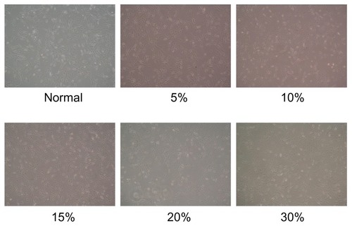 Figure 7 Influence of microemulsion concentration on cellular morphology.