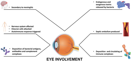 Figure 2 Ocular pathogenesis of Brucella.