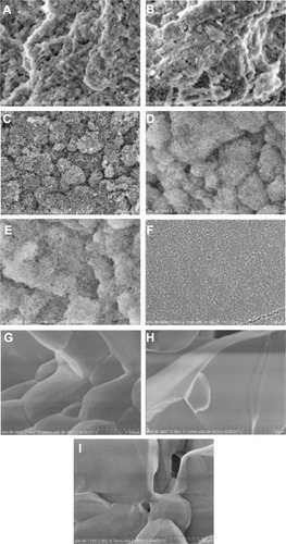 Figure 3 SEM images of all calcium phosphate samples of interest to the present study at higher magnifications.Notes: All images are at a magnification of 40,000× (1 μm scale bar). (A) Cancellous bone, (B) cortical bone, (C) porous nano-HA, (D) porous nano-TCP, (E) porous biphasic nano-TCP/HA, (F) dense sintered nano-HA, (G) porous silica-substituted micron-HA, (H) porous micron-TCP, and (I) porous biphasic micron-TCP/HA.Abbreviations: SEM, scanning electron microscopy; HA, hydroxyapatite; TCP, tri-calcium phosphates.