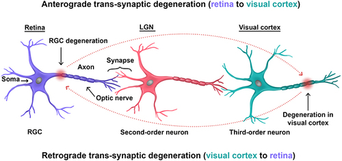 Figure 2 Schematic representation of trans-synaptic degeneration on a cellular scale.