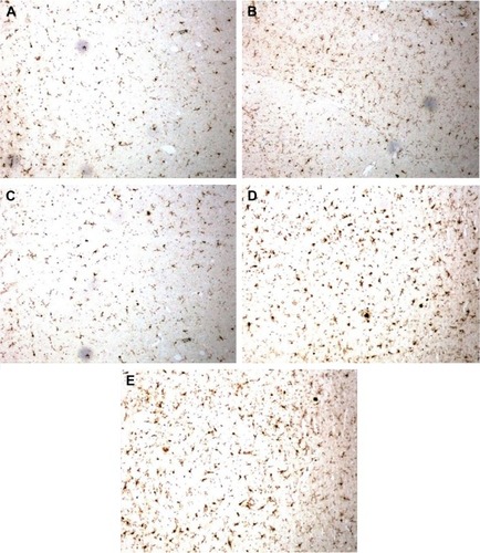 Figure 9 Effects of CTS/PL/β-CD microspheres on the quantities of Iba1 in the hippocampus by immunohistochemistry staining (light microscope, ×400).