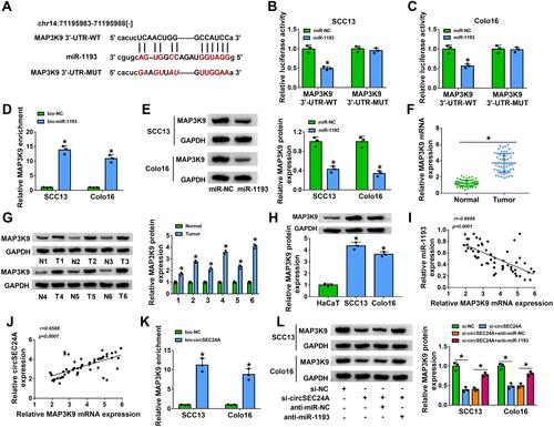 Figure 5 MAP3K9 was a direct target of miR-1193 in CSCC cells. (A) The putative binding sites between miR-1193 and MAP3K9 3ʹ-UTR were predicted by starBase v2.0. (B and C) Relative luciferase activity was determined in SCC13 and Colo16 cells co-transfected with MAP3K9 3ʹ-UTR-WT or MAP3K9 3ʹ-UTR-MUT and miR-1193 or miR-NC (ANOVA). (D) The enrichment of MAP3K9 was determined by RNA pull-down assay in SCC13 and Colo16 cells incubated with bio-NC or bio-miR-1193 (ANOVA). (E) Western blot assay was employed to measure the protein expression of MAP3K9 in SCC13 and Colo16 cells transfected with miR-NC or miR-1193 (ANOVA). (F and G) The mRNA and protein expression of MAP3K9 in normal and CSCC tissues were measured by qRT-PCR and Western blot analyses, respectively (Student’s t-test and ANOVA). (H) Western blot assay was applied to examine the protein expression of MAP3K9 in HaCaT cells and CSCC cells (SCC13 and Colo16) (ANOVA). (I and J) The correlation between MAP3K9 and miR-1193 or circSEC24A expression was analyzed in CSCC tissues (Pearson). (K) The enrichment of MAP3K9 was detected by RNA pull-down assay in SCC13 and Colo16 cells incubated with bio-NC or bio-circSEC24A (ANOVA). (L) The protein level of MAP3K9 was measured by Western blot assay in SCC13 and Colo16 cells transfected with si-NC, si-circSEC24A, si-circSEC24A + anti-miR-NC, or si-circSEC24A + anti-miR-1193 (ANOVA). *P<0.05.