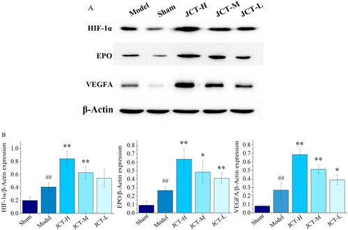 Figure 7. Effects of JCT on the levels of HIF-1α, EPO and VEGFA. (A) Cropped Protein bands. (B) Quantitative analysis of HIF-1α/β-actin, EPO/β-actin and VEGFA/β-actin (n= 5). ##p< 0.01 compared with the sham group; *p< 0.05 and **p< 0.01 compared with the model group.