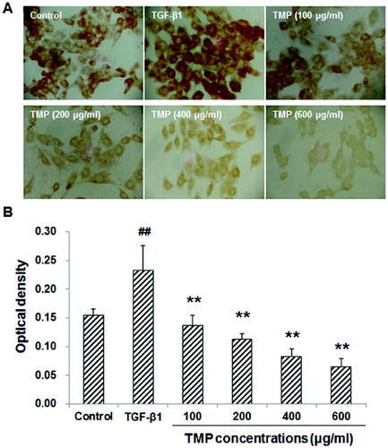Figure 3. Effects of TMP on TGF-β1-induced CTGF expression in HSC-T6 cells detected by immunocytochemistry. (A) Immunocytochemistry was performed to detect CTGF expression in HSC-T6 cells after drug administration (DAB staining, ×200). (B) Quantitative analysis of the average optical density of CTGF staining. n = 6; compared with the control group, ##P < 0.01; compared with the TGF-β1-treated group, **P < 0.01.