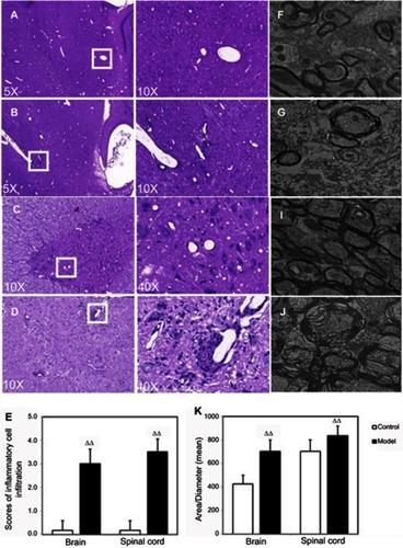 Figure 1 Pathology and ultrastructural observations in experimental autoimmune encephalomyelitis (EAE) model rats. Figures A–D show histological changes in the brains and spinal cords of the EAE model rats, n=7. (E) The inflammatory cell infiltration was assessed by the scores. ΔΔP<0.01 vs control group. (F–I) Ultrastructural changes in the myelin sheaths of the brains and spinal cords of the EAE model rats. Scale bars: magnification: 6000×, n=10. (J) The ultrastructural changes were assessed by the ratios of area/diameter of myelin sheaths. ΔΔP<0.01 vs control group.