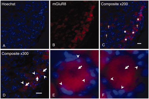 Figure 3. Expression of mGluR8 on trigeminal neurons and SGCs. TG sections were immunostained with rabbit anti-mGluR8 (B) followed by nuclear stain Hoechst (A). A merge (C) is shown, exemplifying positive (stars) and negative (cross) neurons. The same section at 300× magnification (D) shows the characteristic surrounding of neurons (arrows) by SGCs (arrowheads). (E) A positive neuron at higher magnification, where SGCs (arrowheads) are located within the immunoreactive area (arrow), indicating that these SGCs express mGluR8, whereas (F) shows another positive neuron, with SGCs (arrowheads) located outside the immunoreactive area, indicating that these SGCs do not express mGluR8. Magnification = 200× (A, B and C) and 300× (D). Scale bars = 50 µm. TG, Trigeminal ganglion; mGluR: metabotropic glutamate receptor; SGCs: satellite glial cells.