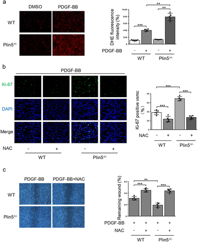 Figure 4. NAC reverses elevated proliferation and migration of VSMC induced by plin5 knockdown. (a) After DMSO or PDGF-BB (30 ng/mL) treatment for 48 h, VSMC isolated from WT or Plin5± mice was stained with DHE (red). Representative images (left) and corresponding quantification of DHE fluorescence (right) were shown (n = 5). Magnification 400 × . (b) VSMC isolated from WT or Plin5± mice was incubated with DMSO or NAC (10 nmol/L; 8 h) and received 48 h of PDGF-BB (30 ng/mL) treatment. Then, VSMC was stained with Ki-67 (green) and DAPI (blue). Representative images (left) and corresponding quantification of Ki-67 positive VSMC (right) were shown (n = 5). Magnification 400 × . (c) Migration of VSMC was measured via wound healing assay. Representative images (left) and corresponding quantification of healing rates (right) were shown (n = 5). Magnification 100 × . *P < 0.05, **P < 0.01 and ***P < 0.001 denote statistical comparison between the two marked groups, respectively. Data are shown as mean ± S.D.