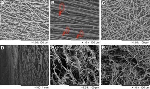 Figure 2 SEM images of electrospinning scaffolds.Notes: (A) Aligned gelatin/P(LLA-CL) nanofibers scaffold; (B) aligned gelatin/P(LLA-CL) nanoyarn fibers scaffold; and (C) random PLLA/gelatin fibers. (D) Cross-section image of hybrid scaffold. Three-dimensional porous nanofibrous scaffold, before cross-linked (E) and after cross-linked (F). Red arrows and ellipses in (B) indicate the formation of nanoyarn fibers.Abbreviations: P(LLA-CL), poly(l-lactide-co-caprolactone); PLLA, poly(l-lactide); SEM, scanning electron microscope.