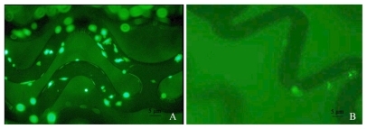 Figure 5 GFP expressions in A10 cells incubated with pEGFP-C1 loaded NP-stents. A) pEGFP-C1-loaded NP-stents; B) dodecylated chitosan-coating stent (no plasmid DNA) (FITC, 100×).