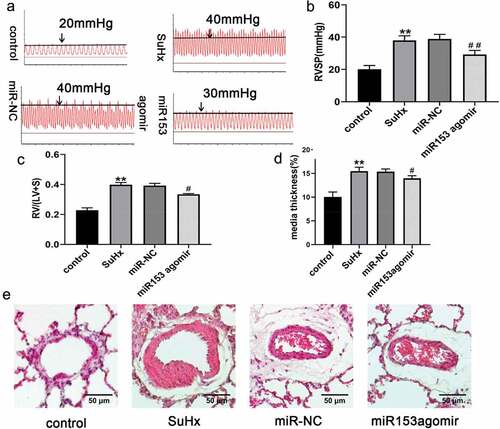 Figure 3. MiRNA153 alleviates SuHx-induced PH and right ventricular function in rats. (a) RV systolic pressure traces. (b) RVSP was measured by right-sided heart catheterization with a pressure transducer microcatheter. (c) RV/(LV+S) ratio. (d)The media wall thickness of small pulmonary artery. (e)Representative images of H&E staining of lung sections (70–100 μm, 400× magnification). N = 10 for each group, *P < .05, **P < .01 vs control group; #P < .05, ##P < .01 vs miR-NC group. The results are expressed as the mean ± SEM. miRNA153, microRNA153; SuHx, SU5416 combined with hypoxia; PH, pulmonary hypertension; RVSP, right ventricular systolic pressure; RV, right ventricle; LV, left ventricle; S, septum; H&E, hematoxylin and eosin SEM, standard error of mean.