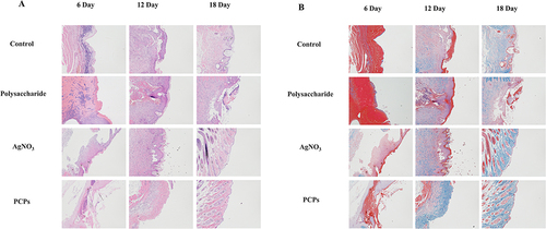 Figure 5 Pathological section. Skin samples were obtained on days 6, 12, and 18 for staining with H&E (A)and Masson (B).