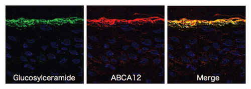 Figure 2 Immunofluorescence labeling using ultrathin cryosections as substrates reveal that glucosylceramide (green) and ABCA12 (red) overlap in the granular layers (derived from ref. Citation5).