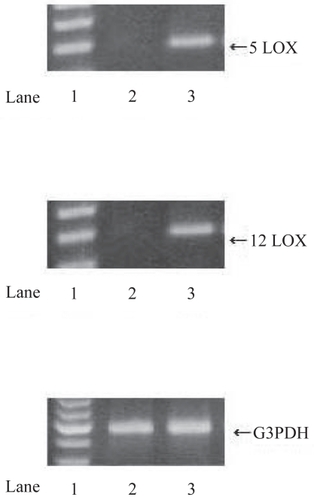 Figure 2 RT-PCR analysis of 5- and 12-LOX in RCC tissues and normal kidney (NK) tissues. Using specific primers for 5-LOX, 12-LOX and G3PDH, the amplification predicted fragments of 337 bp for 5-LOX, 345 bp for 12-LOX and 598 bp for G3PDH in length. A; 5-LOX, B; 12-LOX, C; G3PDH. Lane 1; markers, Lane 2; NK tissues, Lane 3; RCC tissues. RCC tissues expressed significant 5- and 12-LOX mRNA bands while NK tissues expressed no 5- and 12-LOX mRNA bands.
