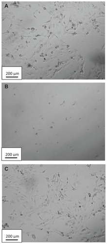 Figure 5 Bright-field images of human ovarian surface epithelial cells after being exposed to (A) no treatment (control), (B) doxycycline at 2 μg/mL, and (C) DCNP4 at 2 μg/mL.Note: Magnification 10×.