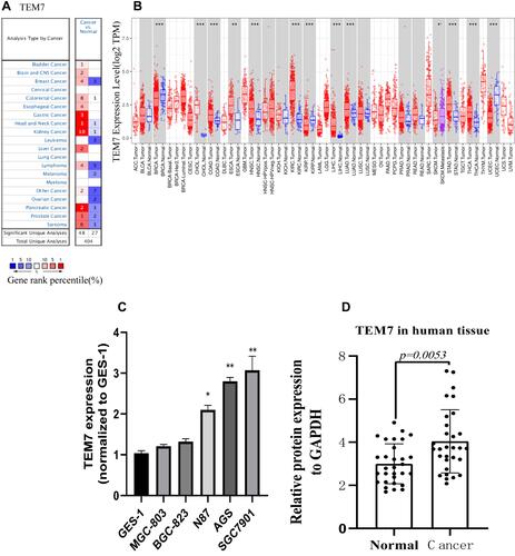 Figure 1 TEM7 expression level in different types of human cancers. (A) High or low expression of TEM7 in different human cancer tissues compared with normal tissues using the Oncomine database. (B) The level of TEM7 expression in different tumor types from the TCGA database in TIMER. (C) The expression level of TEM7 was higher than that of GES-1 in three kinds of GC cells (AGS, SGC-7901 and N87). (D) qRT-PCR analysis of TEM7 mRNA expression in 30 pairs of GC tissues and adjacent nontumor tissues.