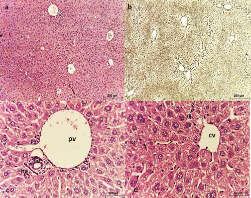 Figure 4. Photomicrograph of sections of liver of negative control mice showing normal architecture. (a, c, & d) stained with Hx & E, (b) stained with silver nitrate. (a) shows each lobule has a central vein (CV) located in the center, (b) shows reticulin fibers distribution, (c) shows portal triad consisting of a branch of the portal vein (PV), a small branch of hepatic artery (ha) and a bile ductule (bd), (d) shows strands of hepatocytes separated by sinusoids around a central vein (cv).