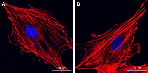 Figure 7 Fluorescence microscopy images of cells double stained with phalloidin for actin filaments (red) and DAPI for nuclei (blue) on Ti (A) and USP-Ti (B) samples.Abbreviations: USP-Ti, Ti surface subjected to USP; USP, ultrasonic shot peening; Ti, titanium.