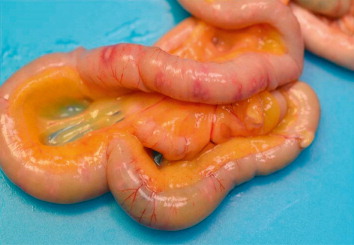 Figure 1. Intestinal ulceration visible through the serous membrane of the intestine.