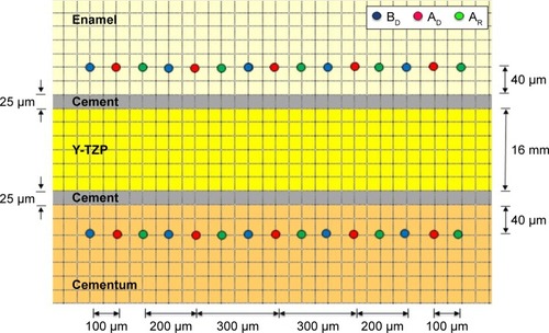 Figure 2 VHN of enamel and cementum was determined at BD, AD, and AR (5 locations each, 100 microns apart) at 40 microns from the enamel–resin cement junction and the cementum–resin cement junction.Abbreviations: AD, after demineralization; AR, after remineralization; BD, before demineralization; VHN, Vickers microhardness.