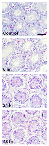 Figure 1. Adverse effects of cadmium on the testis assessed by histological analysis. Rats (~300 g b.w.) were treated with a single dose of cadmium chloride (suspended in 0.9% saline) at 3 mg/kg b.w. via intraperitoneal injection (i.p.). Thereafter, rats in groups of n = 3 were terminated at 6, 24, and 48 h. Paraffin sections of sections were stained by hematoxylin and eosin for histological analysis. It is noted that by 24 h post treatment, germ cells were found to detach from the basement membrane in the tunica propria; and by 48 h, virtually all elongating/elongated and round spermatids, as well as spermatocytes were found in the tubule lumen in > 98% of the tubules. Bar = 100 μm in top panel, which applies to all other micrographs.