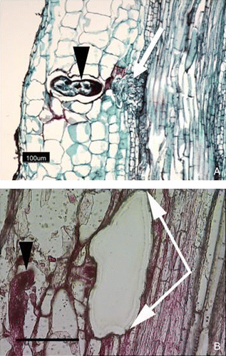 Figure 1.  (Color online). Microdissection of the syncytium formed by H glycines in the roots of G. max. (A) Eight day post infection (dpi) time point syncytial cell (white arrow) prior to microdissection identified by their proximity to H glycines (black arrowhead)s; (B) A syncytial cell after microdissection; microdissected syncytial cell (area between white arrows); nematode (black arrowhead) Bar, 100 µm