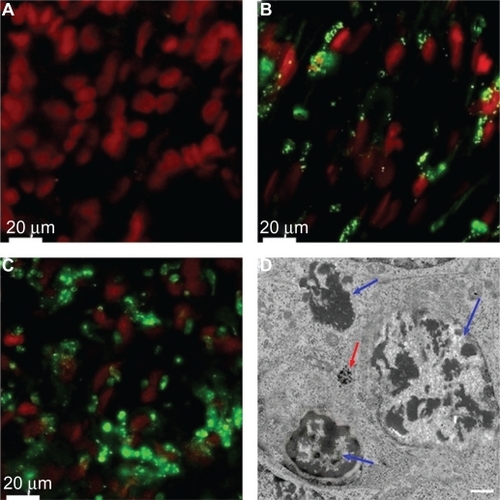 Figure 6 Confocal imaging of the tissue samples after intra-arterial FITC-HSA-MWCNT administration (A–C). Electron microscopy of tumor tissue after HAS-MWCNT-mediated photothermal treatment. A) Surrounding pancreatic tissue. B) Peripheral area of the tumor. C) Central region of the tumor (red, nuclei stained by DRAQ5™ coloration; green, intracellular FITC-HSA-MWCNTs). Results are representative of three experiments. D) Electron microscopy demonstrates necrotic features with disintegrated nuclei in the tumor tissue after treatment (blue arrows). Intracellular clusters of MWCNTs could also be demonstrated (red arrows). Scale bar: 2 μm.Abbreviations: FITC, fluorescein isothiocyanate; HSA, human serum albumin; MWCNT, multiwalled carbon nanotubes.