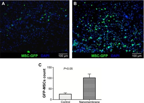 Figure 6 Observation of the frozen sections.Notes: (A) Engraftment of the GFP-MSCs into the wounds of the control group; (B) engraftment of the GFP-MSCs into the wounds of the nanomembrane group. Both tissue sections of the wounds in the two groups were immunostained with an antibody against GFP at day 7 after surgery. MSC-GFPs (green) were engrafted into the newly formed tissue. The nuclei were stained with DAPI (blue). Scale bar: 100 µm. (C) Average GFP-MSC counts for the two groups. P<0.05.Abbreviations: DAPI, 4′,6-diamidino-2-phenylindole; GFP, green fluorescent protein; MSC, mesenchymal stem cell.