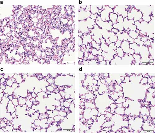 Figure 5. Lung pathology study showed that more neutrophil infiltration was found in lung interstitium of mice treated with ceftazidime-induced bacterial membrane vesicles (CAZ-BMV) than those treated with imipenem-induced bacterial membrane vesicles (IMP-BMV). Increased neutrophil infiltration occurred in the CAZ-BMV group (a), whereas no significant neutrophil recruitment in the IMP-BMV (b), LB-BMV (c), and control (d) group. Mice intraperitoneally administered 30 μl of phosphate-buffered saline (PBS) were used as control group