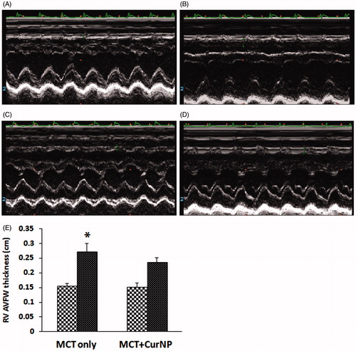 Figure 3. Cur NP treatment attenuates PAH induced increase in RV anterior free wall thickness. M-mode echocardiography images of a MCT only animal at day 1 (Panel A) and at day 28 (Panel B). Images from a MCT + Cur NP treated animal at day 1 (Panel C) and at day 28 (Panel D). Quantification of RV AVFW echocardiography (Panel E). Values are expressed as mean ± SEM; n = 6 for each group. *P < 0.05 versus base line of MCT only group.