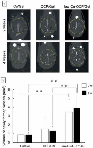 Figure 8. Micro-CT images of decalcified calvarial tissues around the region of defects treated with Cu/Gel, OCP/Gel, and low-Cu-OCP/Gel at 2 and 4 weeks of post-implantation (a). Inside of yellow circles in the micro-CT images indicates the region of defects. Quantitative analysis of volume of newly formed vessels in ROI of the calvarial defects treated with Cu/Gel, OCP/Gel, and low-Cu-OCP/Gel at 2 and 4 weeks of post-implantation. (*p < 0.05 and **p < 0.01).