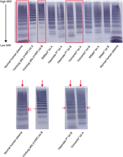 Figure 5 Multimer composition of VWF concentrates: high-resolution agarose electrophoresis. Enlarged images of selected lanes are shown in the lower panel; Voncento® and Haemate P® exhibit a different satellite band pattern from normal human plasma, as indicated by the arrows. The faster- and central-migrating bands appear more intense, whereas the slower-migrating satellite band is very faint. Vonicog alfa (rVWF) is composed of intact multimers without satellite bands.