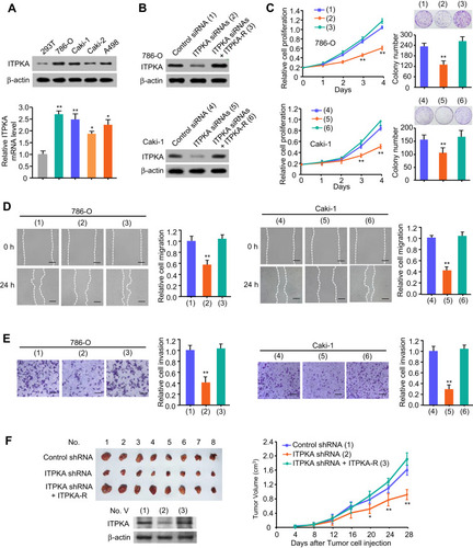 Figure 2 ITPKA promotes RCC proliferation, migration and invasion both in vitro and in vivo. (A) Total proteins extracted from the indicated RCC cell lines were analyzed by Western-blot with anti-ITPKA. β-actin was used as a loading control. (B) 786-O and Caki-1 cells were transfected with Control siRNA or ITPKA siRNAs or ITPKA siRNAs plus ITPKA. The immunoblot shows ITPKA expression. (C) Cell proliferation and colony formation, wound healing (D) and transwell (E) assays of 786-O and Caki-1 cells transfected as in (B). (1), (2), (3) represent 786-O cells transfected with Control siRNA, ITPKA siRNAs, ITPKA siRNAs plus ITPKA, respectively. (4), (5), (6) represent Caki-1 cells transfected with Control siRNA, ITPKA siRNAs, ITPKA siRNAs plus ITPKA, respectively (B–D). Illustrative images show colonies in plates, cell migration and invasion. Histograms show colony number, comparative cell migration and invasion. All values displayed are mean ± SD and have been duplicated 3 times with similar results (A–D). *p < 0.05 and **p < 0.01 versus corresponding Control siRNA. (F) 786-O cells stably infected with lentivirus carrying the indicated constructs were injected into nude mice as indicated. After 28 days, mice were sacrificed to harvest tumors. At the indicated times, the tumors were measured (mean ± SD, n = 8), and the growth curve was plotted. **p < 0.01 vs. Control shRNA group.