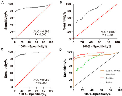 Figure 2 LncRNA HOTAIR combined with Glactin-3 had higher diagnostic efficiency in differentiating benign thyroid tumor from PTC. (A) ROC curve analysis of diagnostic efficacy of lncRNA HOTAIR; (B) ROC curve analysis of diagnostic efficacy of Glactin-3; (C) ROC curve analysis of diagnostic efficacy of the combination of LncRNA HOTAIR and Glactin-3; (D) ROC curve was used to compare the diagnostic efficacy of lncRNA HOTAIR, Glactin-3, and their combination.