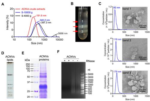 Figure 1 Preparation, characterization and composition analysis of ACNVs. (A) Size distribution changes during the isolation process as visualized by DLS. S-4000 g and S-10,000 g was the supernatant after centrifugation at 4000 g and 10,000 g, respectively. (B) Three bands formed after sucrose gradient ultracentrifugation. (C) The size and morphology of each sucrose-gradient band was characterized by NTA and TEM, respectively. Scale bar =200 nm. (D) TLC analysis of ACNVs lipids. The lipids from ACNVs were separated on a TLC silica gel plate and visualized with CuSO4 phosphoric acid solution. (E) Protein gel of ACNVs proteins. The proteins extracted from ACNVs were separated by SDS-PAGE and stained with Coomassie blue staining. (F) RNA gel of ACNVs RNAs. The RNAs extracted from ACNVs were treated with or without RNase and run on a 1% agarose gel. The RNA ladder of 100−5000 nucleotides (nt) was used.