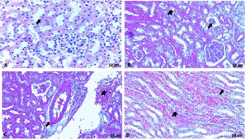 Figure 2. (A–D) Light photomicrograph of sections from maternal kidney of control (A) and GAE received group (B–D) stained with H & E.: light photomicrograph of (A) shows intact renal tubules and intact glomeruli. Photomicrograph of (B) shows shrinkage and atrophy of glomeruli (arrow), besides necrosis of the renal tubules (star). Photomicrograph of (C) shows thickening and congestion of the blood vessels. Photomicrograph of (D) shows fibrous tissues infiltration (arrow), also congestion of the tubules (arrow).