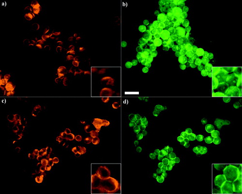 Figure 5 Distribution of E-cadherin and F-actin in aggregated PZ-HPV-7 (a and b, respectively) and DU-145 (c, d) cells levitated for 1 h. E-cadherin in PZ-HPV-7 cells has accumulated at the cell–cell interface in a granular pattern (a), possibly associated with the formation of adherens junctions, whereas the internal regions of high phalloidin stain, shown in the 1 min samples (Figure 4b) are still present (b). DU-145 cells retained the ring-type pattern at the periphery of the cells, while a more intense staining was often not confined to a cell-cell contact region (c), while F-actin had clearly concentrated at the cell–cell interface (d) with no evidence of internal high phalloidin stain regions. Zoom-in images highlight the distribution pattern. Scale bar is 50 μ m.