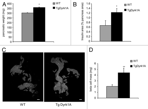 Figure 4. Islet morphometry in wild-type and mBACTgDyrk1A mice. (A) Increased pancreatic weight in mBACTgDyrk1A mice relative to wild-type mice. (B). Quantification of the insulin-stained area in mBACTgDyrk1A compared with wild-type mice. (C) Immunodetection of insulin (white dots) in pancreatic sections of 12-wk-old mice wild-type and mBACTgDyrk1A mice Scale bar: 5 mm. (D) Absolute β cell mass in mBACTgDyrk1A compared with wild-type mice. Data are shown as mean ± SEM of at least 3 independent experiments. *P < 0.05; **P < 0.01
