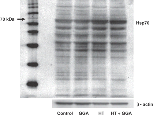Figure 1. The accumulation of Hsp70 proteins induced by pretreatment with GGA and/or hyperthermia. Colon26 adenocarcinoma cells were pretreated with GGA and/or hyperthermia. The induction of Hsp70 24 h after treatment is shown. The accumulation of Hsp70 was assessed by western blotting. Lane 1, untreated control cells; Lane 2, pretreatment with GGA; Lane 3, pretreatment with hyperthermia; Lane 4, pretreatment with GGA plus hyperthermia. We used β-actin as a loading control and found the molecular weight of Hsp70 (70 kD).