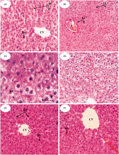 Figure 2. Photomicrographs of the liver sections in male albino rats (H&E) (A) control group, (B,C) group fed fructose/HFD supplements, (D) group treated with AT suspension, (E) group treated with NLC-1 and (F) group treated with commercial product.