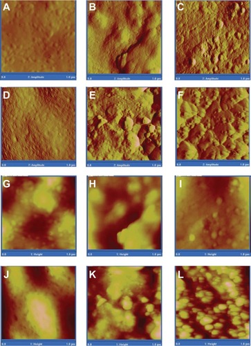 Figure 10 Atomic force micrographs of amplitude (A–F) and height (G–L) of PMMA, PMMA with MgO, PMMA with HAp, PMMA with CS, PMMA with BaSO4, and PMMA with SiO2.Abbreviations: CS, chitosan; HAp, hydroxyapatite; MgO, magnesium oxide; PMMA, poly(methyl methacrylate); BaSO4, barium sulfate; SiO2, silica.