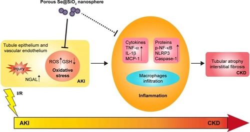 Figure 8 The description of porous Se@SiO2 nanospheres attenuating ischemic AKI injury and improving prognosis.Note: Porous Se@SiO2 nanospheres attenuate ischemic AKI injury and improve prognosis by reducing the severity of injury in early AKI, resisting oxidative stress, relieving inflammation, and preventing further transition of AKI to CKD.Abbreviations: AKI, acute kidney injury; GSH, glutathione; CKD, chronic kidney disease; TNF-α, tumor necrosis factor-α; IL-1β, interleukin-1β; MCP-1, monocyte chemotactic protein-1; p-NF-κB, phosphorylated nuclear factor-κB; NLRP3, NACHT, LRR, and PYD domains-containing protein 3; NGAL, neutrophil gelatinase-associated lipocalin.