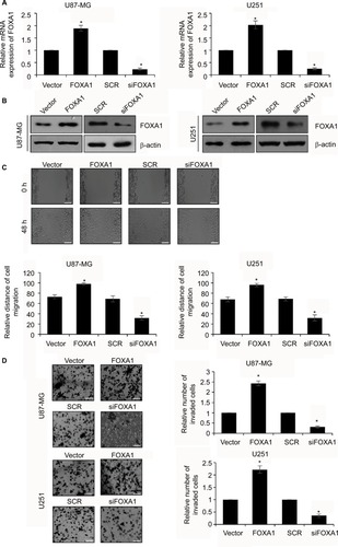 Figure 2 Upregulation of FOXA1 facilitates migration and invasive ability of glioma cells.Notes: (A) and (B) FOXA1 over-expression and knockdown cells were successfully established. The expression of FOXA1 was established using qRT-PCR and western blotting assay. (C) Cell migration rate was markedly higher in FOXA1 over-expression group while was lower in FOXA1 inhibition group. Magnification ×10; scale bars =200 μm. (D) More invaded cells were seen in FOXA1 over-expression group, while there were less invaded cells in FOXA1 inhibition group. Magnification ×20; scale bars =100 μm. *p < 0.05, compared with vector or SCR group.Abbreviations: FOXA1, forkhead box A1; qRT-PCR, quantitative reverse transcription-polymerase chain reaction; SCR, scramble siRNA.