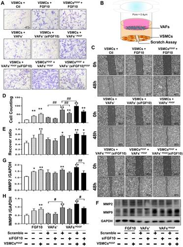 Figure 4 Both exogenous FGF10 and VAFs-derived FGF10 promote VSMCs migration. (A and C) Evaluation of VSMCs migration by Transwell assay (A) and scratching assay (C) and quantitative analyses (D and E). (B) Schematic illustration of VAFs-VSMCs co-cultured system in which co-cultured VSMCs were used for scratching assay and WB analyses of MMP2 and MMP9. (F–H) Representative WB images (F) and their quantitative analyses (G and H) of MMP2 and MMP9 protein expressions in co-cultured VSMCs under different conditions as indicated. n=3. *p<0.05, **p<0.01 compared with Ctl. #p<0.05, ##p<0.01 between two groups as indicated.