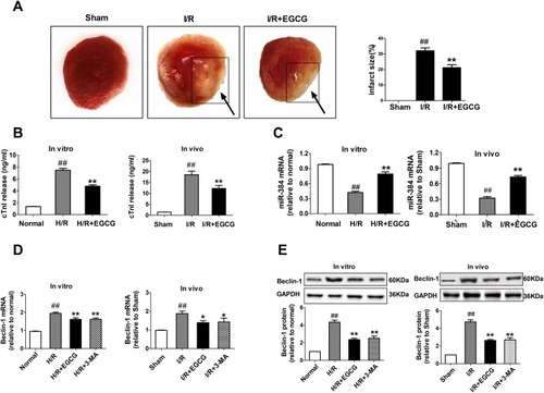 Figure 2 EGCG increased the miR-384 and attenuated Beclin-1 levels in I/R- induced myocardial injury.