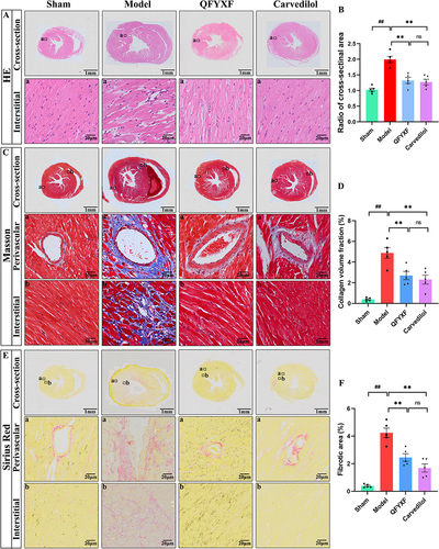 Figure 3 QFYXF inhibits cardiac hypertrophy and myocardial fibrosis induced in HF mice. (A) HE staining; (B) Radio of cross-sectional area (n=5); (C) Masson staining; (D) Collagen volume fraction (n=5); (E) SR staining; (F) Fibrotic area (n=5). Data are presented as Mean ± SEM. Vs sham group, ##P < 0.01; vs model group, **P < 0.01.