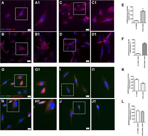 Figure 3 Immunoreactivity for LC3B, SQSTM1/p62 antibodies following VPS35 silencing in brain endothelial cells. Representative microscopy images of control cells (A, A1 inset) and VPS35 silenced cells (B, B1 inset) stained for LC3B (TXred), VPS35 (Cy5 channel pseudo-colored purple), nuclear stain DAPI (blue); (Scale bar = 10 µm). Representative microscopy images of control (C, C1 inset) and VPS35 silenced cells (D, D1 inset) stained for LC3B (TXred), VPS35 (Cy5 channel pseudo-colored purple), nuclear stain DAPI (blue) also treated with BafA1; (Scale bar = 10 µm). (E) LC3B fluorescence intensity nucleus area (***p < 0.001 vs Ctr siRNA cells). (F) LC3B fluorescence intensity nucleus area in BafA1 treated cells (***p < 0.001 vs Ctr siRNA cells). Representative microscopy images of control (G, G1 inset) and VPS35 silenced cells (H, H1 inset) stained for SQSTM1/p62 (TXred), VPS35 (FITC: green) nuclear stain DAPI (blue); (Scale bar = 10 µm). Representative microscopy images of control (I, I1 inset) and VPS35 silenced cells (J, J1 inset) stained for SQSTM1/p62 (TXred), VPS35 (FITC: green), nuclear stain DAPI (blue) also treated with BafA1; (Scale bar = 10 µm). (K) SQSTM1/p62 fluorescence intensity nucleus area (L) SQSTM1/p62 fluorescence intensity nucleus area in BafA1 treated cells. (***p < 0.001 vs Ctr siRNA cells) (N = 3 individual experiments).